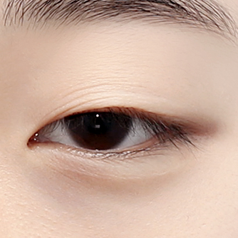 부분절개 눈매교정