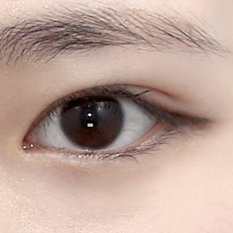 비절개 눈매교정