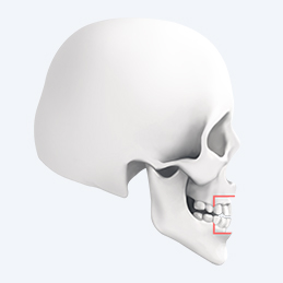 Protruding mouth correction